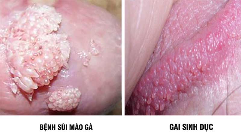 Sui mao ga va gai sinh duc