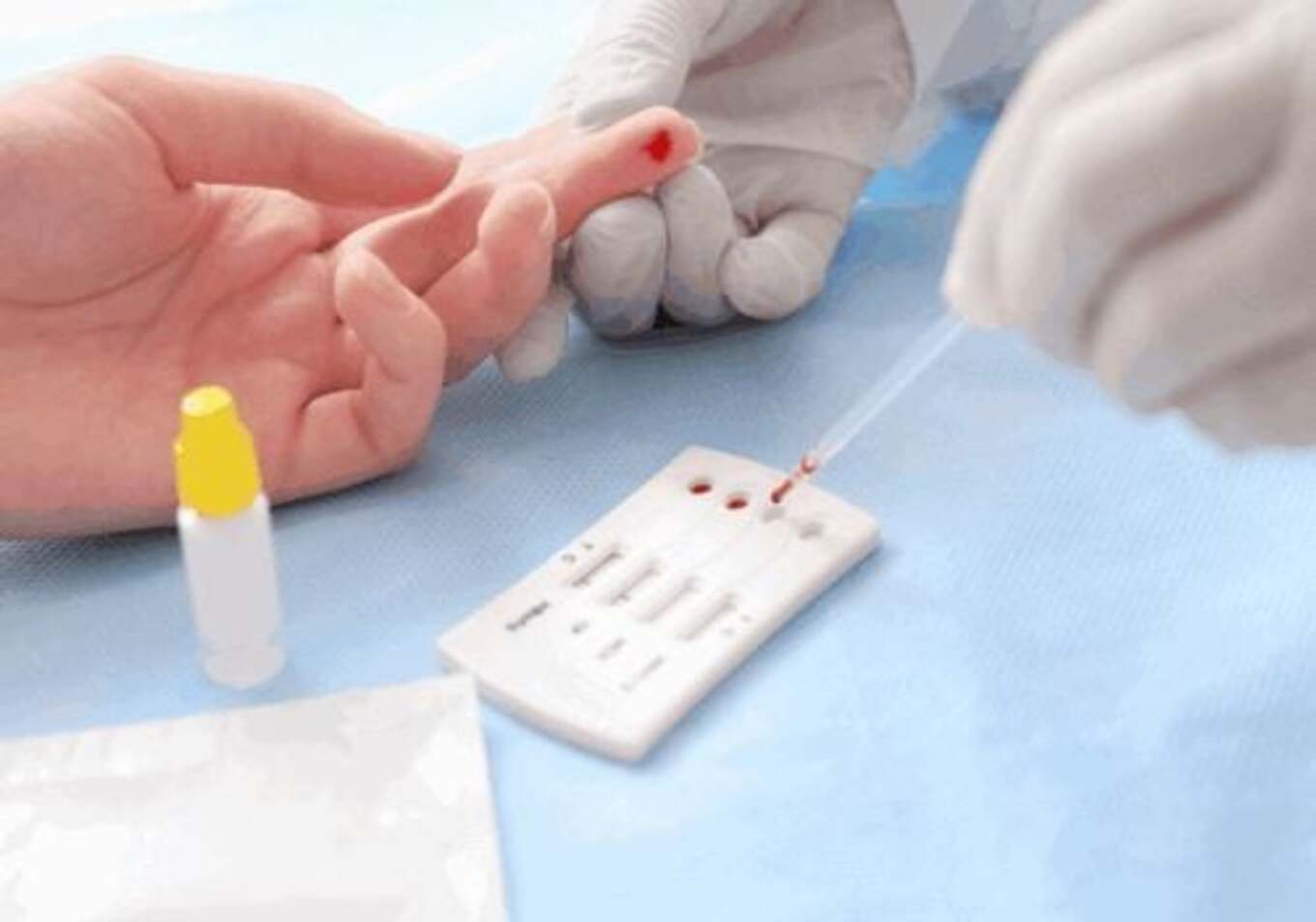 Test Nhanh Giang Mai Có Chính Xác Không? Bác Sĩ Giải Đáp!!!