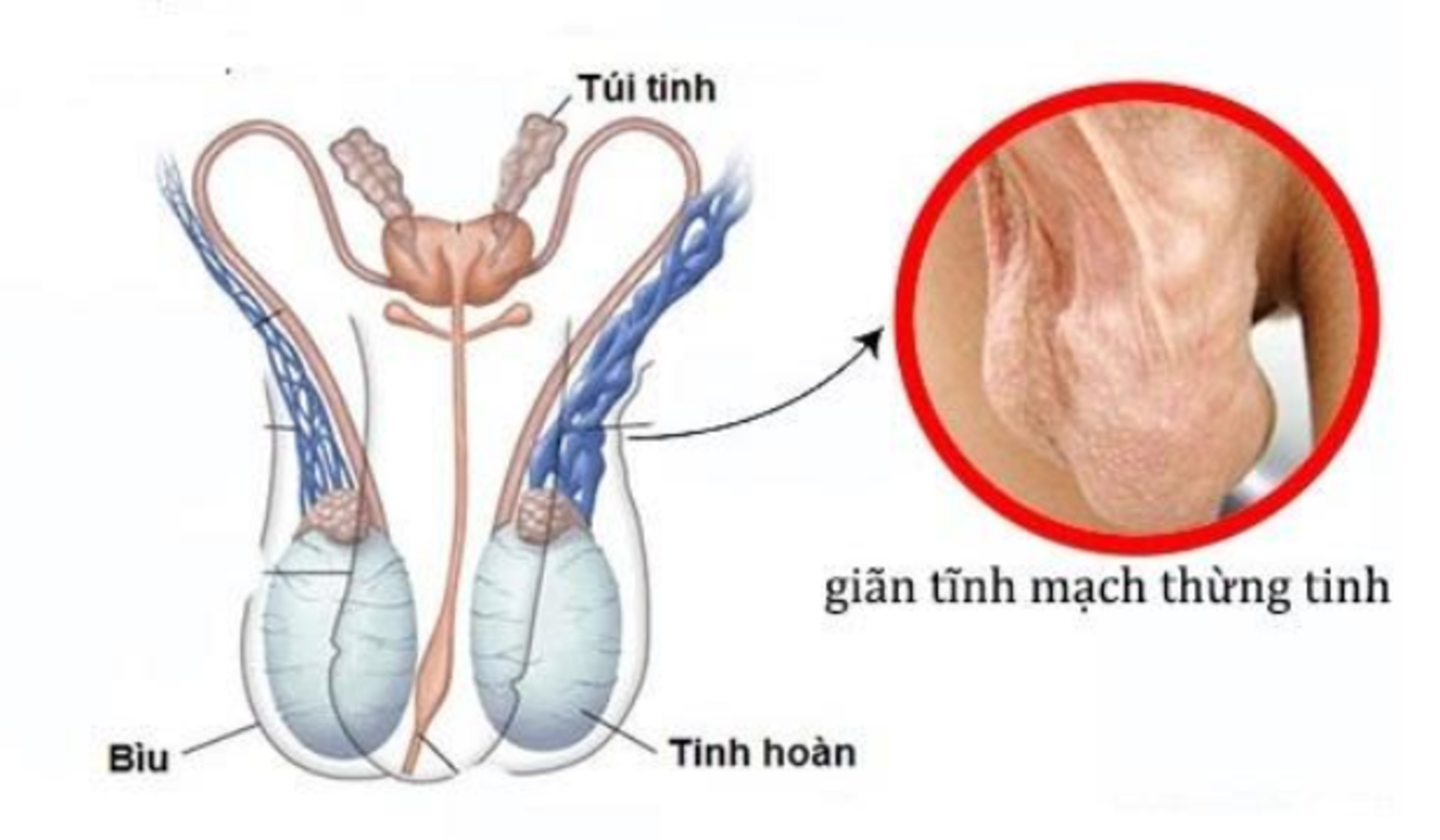 ĐỪNG CHỦ QUAN VỚI CƠN ĐAU &#8220;THẦM KÍN&#8221;!