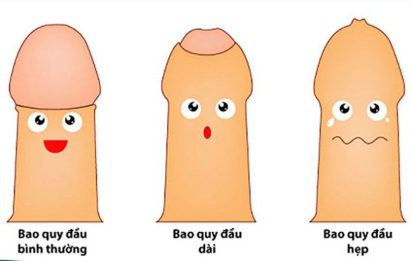 HẸP BAO QUY ĐẦU Ở TRẺ EM!! KHI NÀO CẦN CAN THIỆP!?