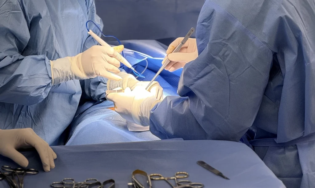 Cắt chọn lọc dây thần kinh lưng dương vật trong điều trị xuất tinh sớm: Chỉ định, hiệu quả và những điều cần biết